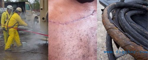 高壓清洗機的使用風險